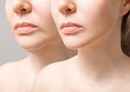 Clear the Air: Why Nicotine and Facelifts Don't Mix